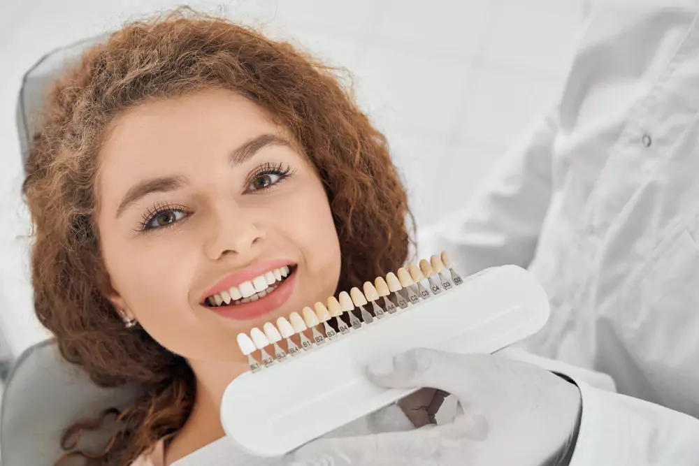 Smile Makeover